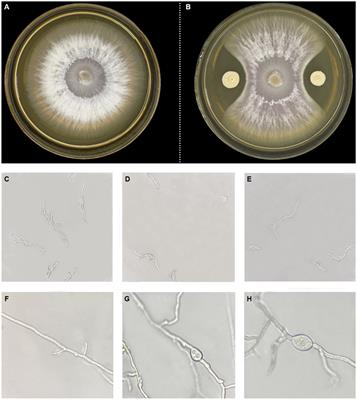 Genome sequencing and analysis of Bacillus velezensis VJH504 reveal biocontrol mechanism against cucumber Fusarium wilt